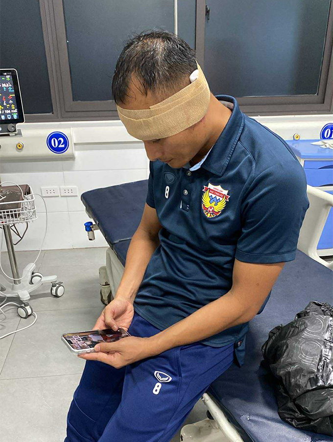 Trọng Hoàng được khâu 10 mũi ở tai trái