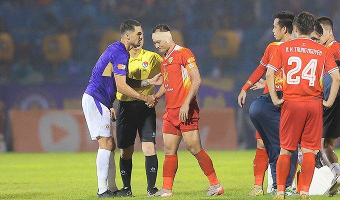 Trọng Hoàng bị thương ở tai trái